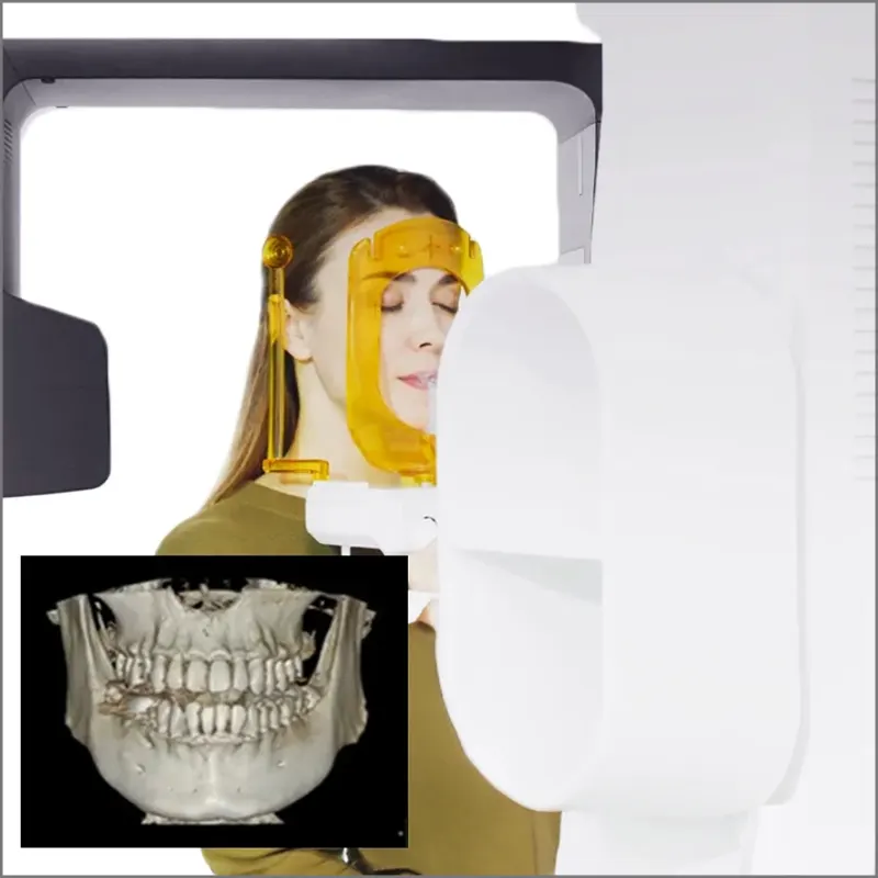 Công nghệ CT Cone Beam 3D giúp khảo sát chi tiết cấu trúc và mật độ xương hàm